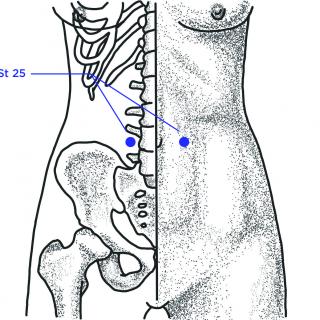 Diarrhea Acupoints | Taking Charge Of Your Survivorship